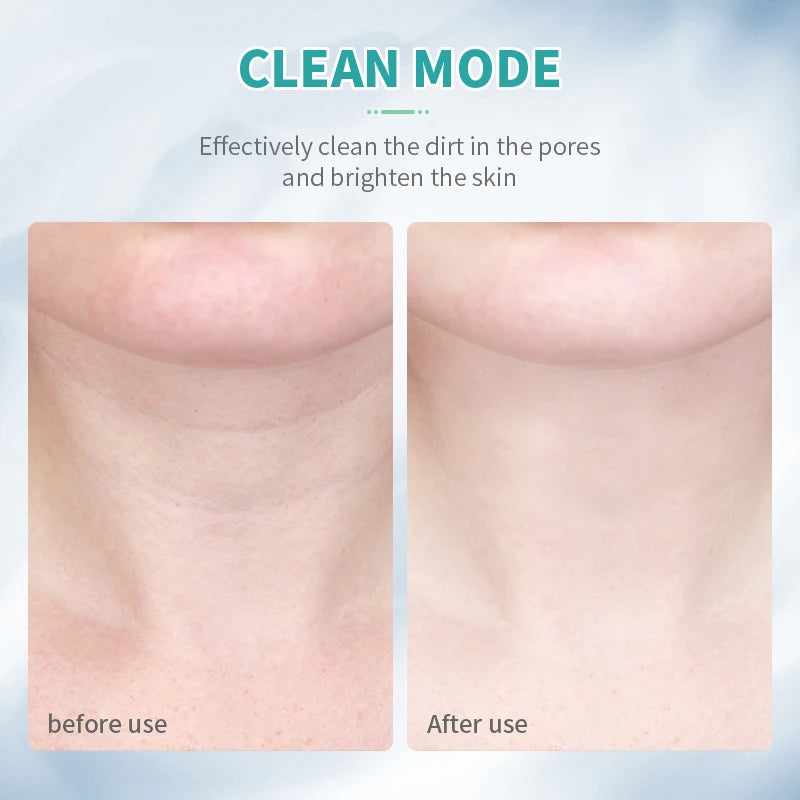 Neck Face Beauty Device EMS Facial Neck Lifting 3