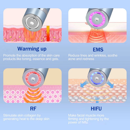 Mini HIFU Machine for Eyes Rechargeable Ultrasound